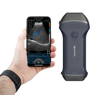 xl pro ultrasound device 2
