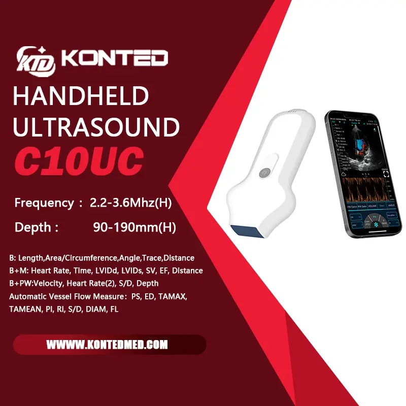 Features of C10UC cardiac wireless probe