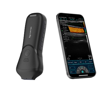 Maintaining and Repairing Abdomen Ultrasound Convex Probes for Safe and Efficient Use