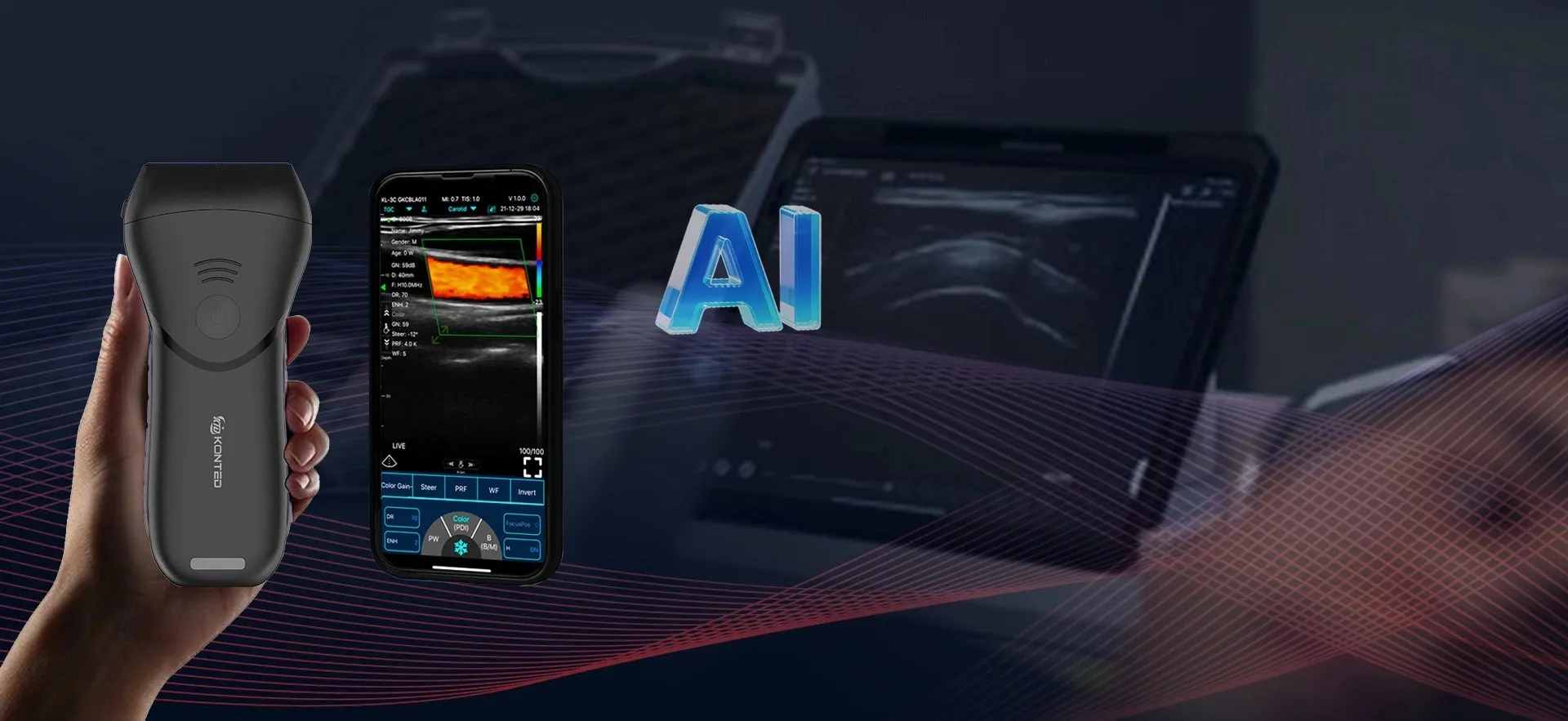 START YOUR HANDHELD<br> ULTRASOUND, EASY TO USE, <br>ANYTIME, ANYWHERE