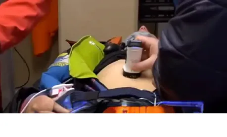 Wireless Ultrasound Probe Used in Emergency Medicine