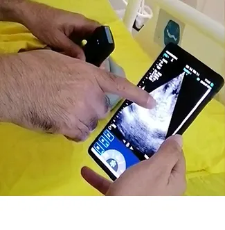 Wireless Ultrasound Probe Used in Cardiology