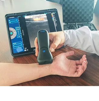 Wireless Ultrasound Probe Used in Vascular